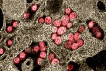 AstraZeneca y la Universidad de Oxford suspenden el ensayo de la vacuna COVID-19 para investigar una posible reacción adversa grave