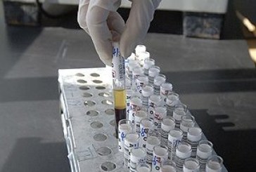Una vacuna fallida contra el VIH, relacionada con mayor riesgo de contraer el virus