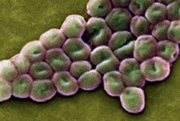 Muere una mujer en EEUU por una bacteria resistente a los antibióticos