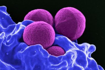 Para 2050 la resistencia a los antibióticos será la principal causa de muerte